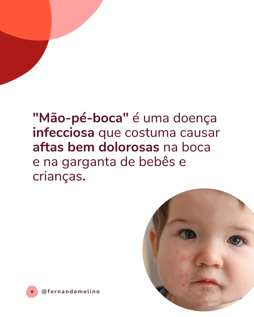 Meu bebê está com "mão-pé-boca" e não quer comer e mamar